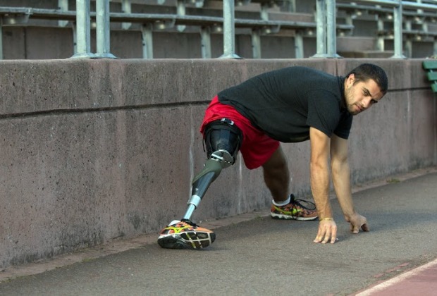 使用3D打印技术开发可调式假腿（图文教程）,使用3D打印技术开发可调式假腿,打印,使用,第1张