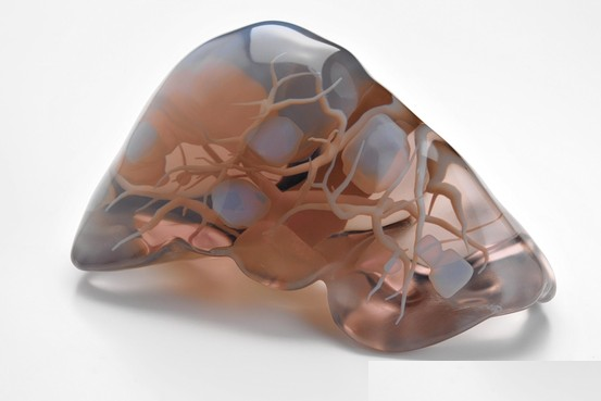 医生用3D打印机制造器官和骨骼(图文教程),打印机,第2张 医生用3D打印机制造器官和骨骼(图文教程),患者的肝副本,打印机,第2张